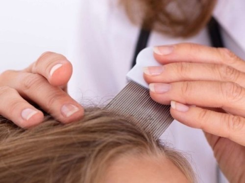 Head Lice 